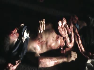 Man killed by a truck (Woman put the guts back inside the body)