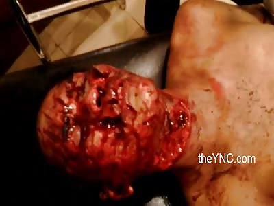 Face disfigured by machete blows