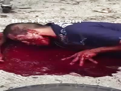 Man With Large Cut in His Neck Bleed Profusely in Agony