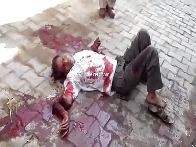 They cut off their hands with machete by resist a assault