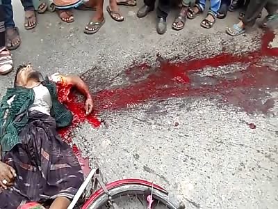 Heart and Lungs on the Road after Being Crushed by Truck