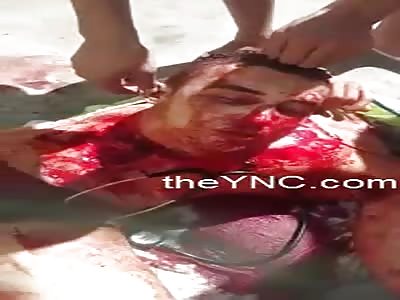 Doc Beheaded By The Same Prisoners From The Prison In Fortaleza