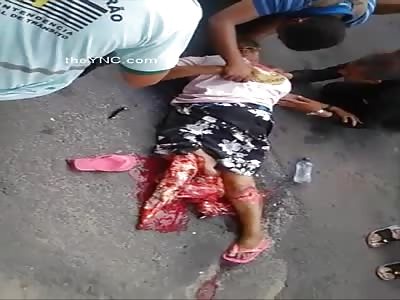 (new angle) Woman Legs Crushed By A Bus