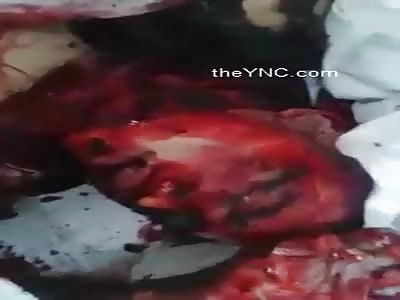 Rapists Were Killed And Burned In Prison