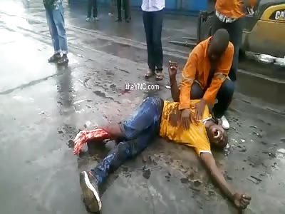 Now That's PAIN: Man With His Torn Leg Crushed By A Machine