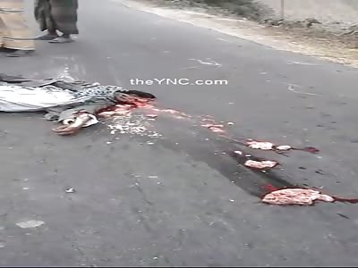 Motorcyclist Dead Man With His Broken Head And Brains On The Street