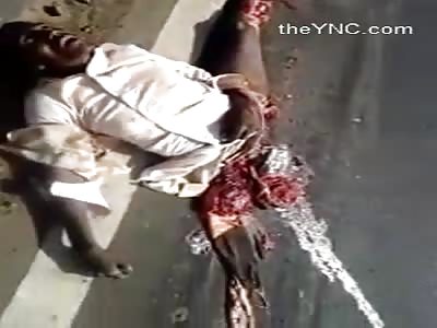 The Man Dies With His Legs Crushed By A Truck