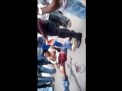 Motorcyclist With Severe Damage To His Crotch