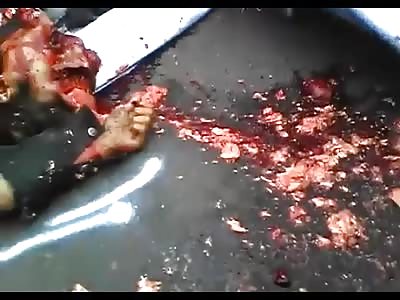 Man Was Crushed And Killed By A Truck