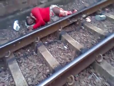 The Man Still Living With His Leg Torn By A Train