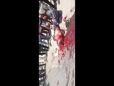 The Man Died With His Head Completely Shattered By A Truck