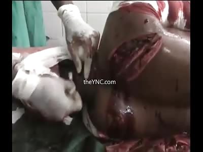 Man Seriously Injured By Machete Blows