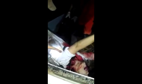 Remove The Body Of A Woman Crushed Between Your Car