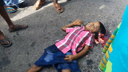 The Boy Died With His Skull Crushed By A Car