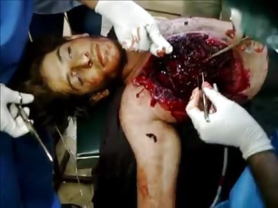 The Man Dying After Receiving Explosion In Chest