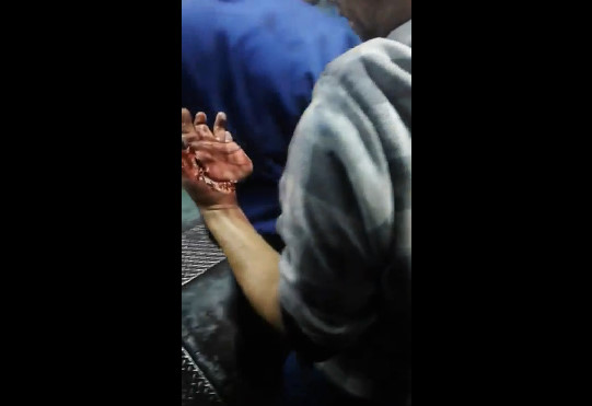 The Worker With His Hand Pressed On A Machine