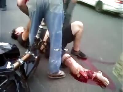 Man Screaming Pain With Leg Severed In Accident