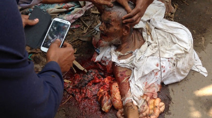 The Old Man Completely Crushed And Busted By A Truck 