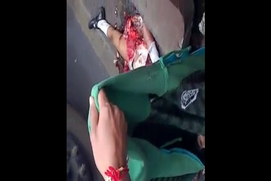 The Girl Dies Hit With His Legs Triturated