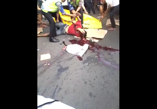 Collect Brains Head Crushed A Pedestrian Hit By A Car