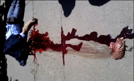 Brain Scattered On The Street After Accident