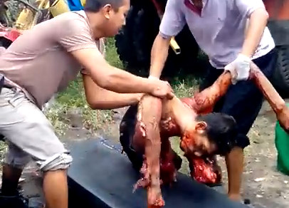 The Man With Her Body Ripped To Pieces By A Truck