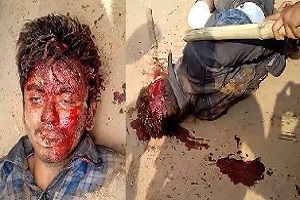 The Thief Was Beaten With Sticks By The Population