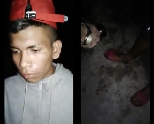 He is Shot in His Foot By Walking Stealing in The Favela