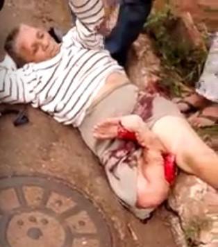 The Most Fucked Up Leg Of The Week .