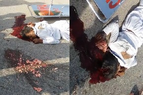 Died With Open Skull - Delicious Brains Scattered On The Street