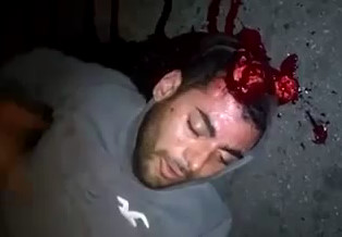 Robber Agonizes With a Bullet Hole in the Head Beating on His Chest