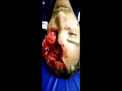 That's How Your Head Stays After a Rifle Shot