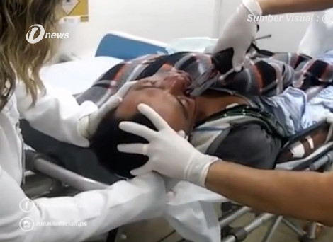 Dr. Remove the Knife skewered  in the Face of a Man