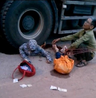 Man in Shock Holds the Legs of His Daughter ripped in Half by Truck