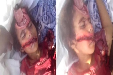 Litle Girl Was Killed With Machete Blows to the Head