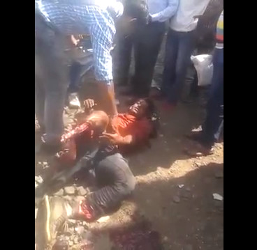 Drunk Man With his Legs Severed in The Train Lines