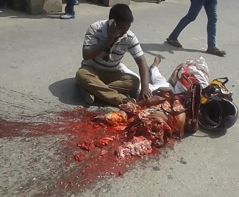 Man in Shock in Front of Body Ripped to Pieces of His Wife