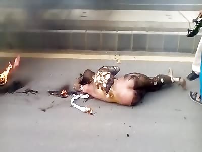 Man Severely Burned After Head On Collision Between Motorcycles