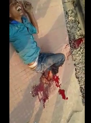 Boy Cries in Pain for His Legs Cut by a Train