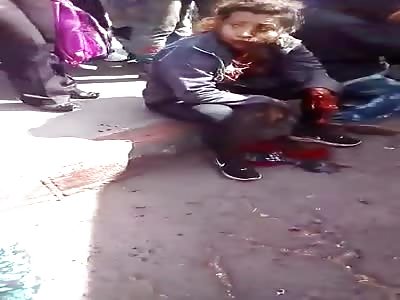 Explodes a grenade in his hand.