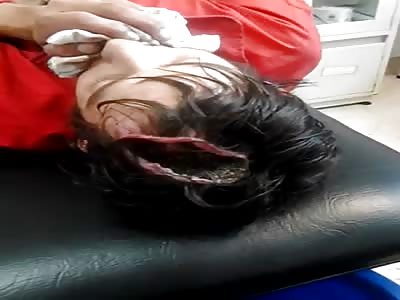 MAGGOTS PROLIFERATE ON A WOUND CAUSED BY MACHETE BLOW