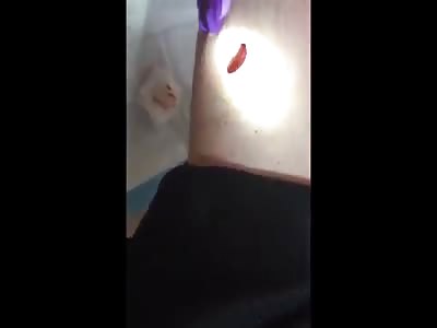 'FRIEND FIRE' ENDS IN PAINFUL GUNSHOT WOUND 