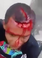 THIEF IS HUNTED IN THE STREETS AND INJURED BY MACHETE