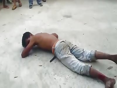 SUICIDE ATTEMPT LEAVES MAN FEET INJURED