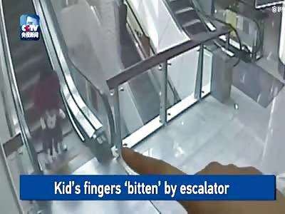 KID'S FINGERS 'BITTEN' BY ESCALATOR