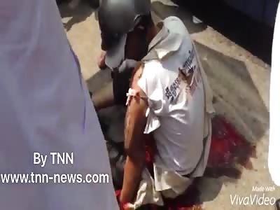 RIDER HAD ARM CRUSHED IN ACCIDENT 