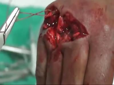 JEALOUS HUSBAND CHOPS WIFE'S HAND