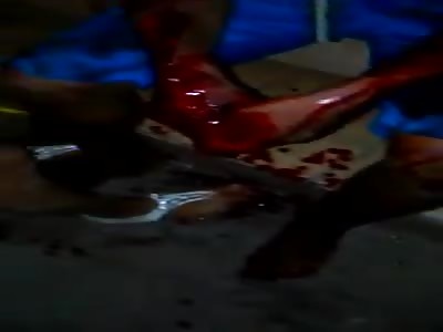 HE WAS SERIOUSLY INJURED BY MACHETE BLOWS