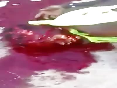 Man Was Brutally Attacked (Disfigured by Machete Blows in Head and Face)