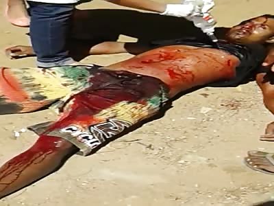 MAN DYING AFTER BEING STABBED 